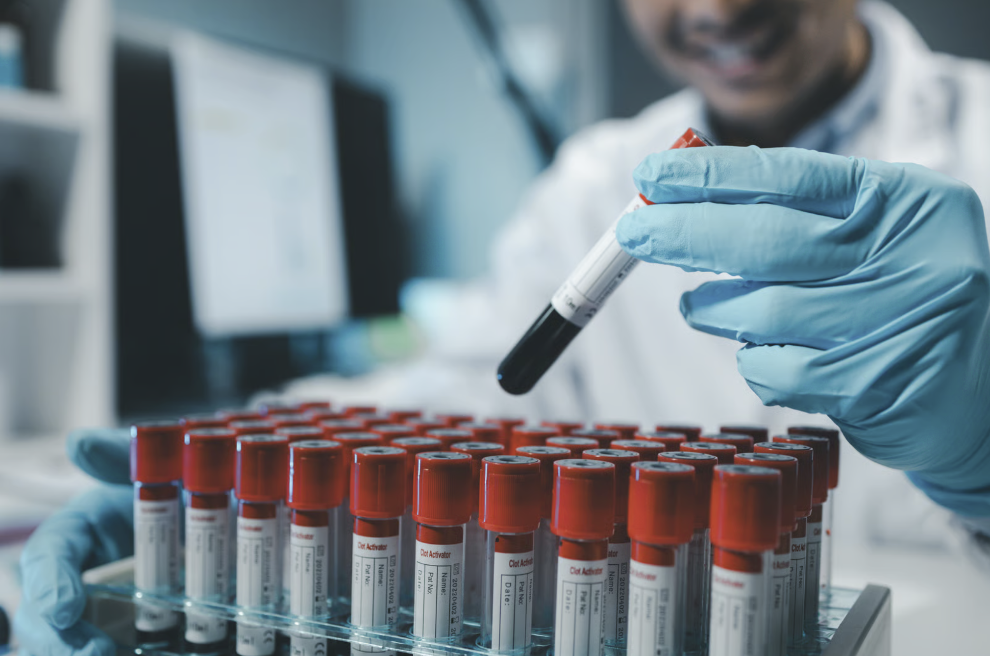 Rhythm Biosciences